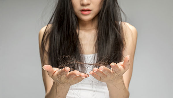 脱发的原因有哪些 哪些因素会导致脱发